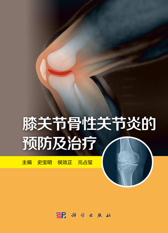膝关节骨性关节炎的预防及治疗
