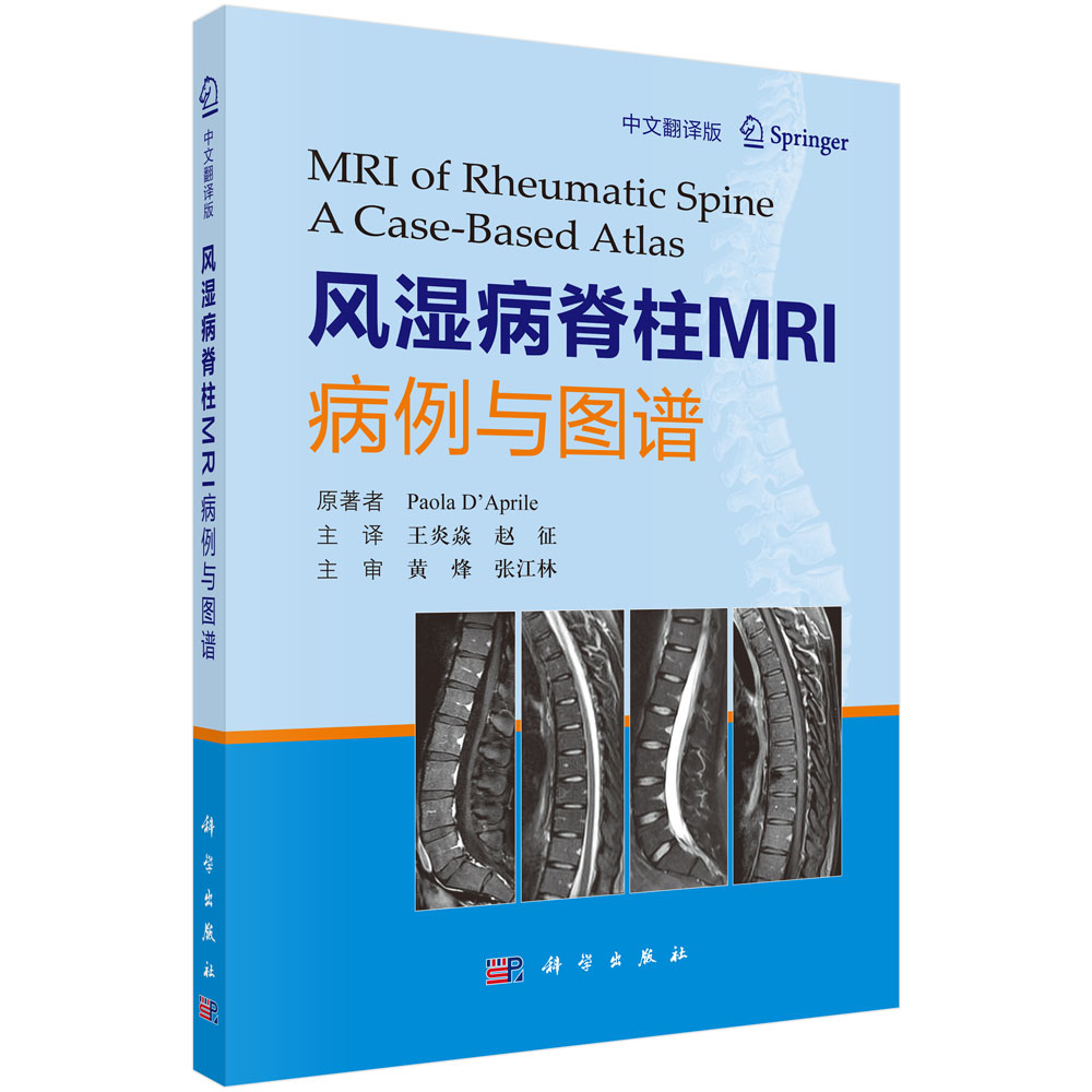 风湿病脊柱MRI病例与图谱