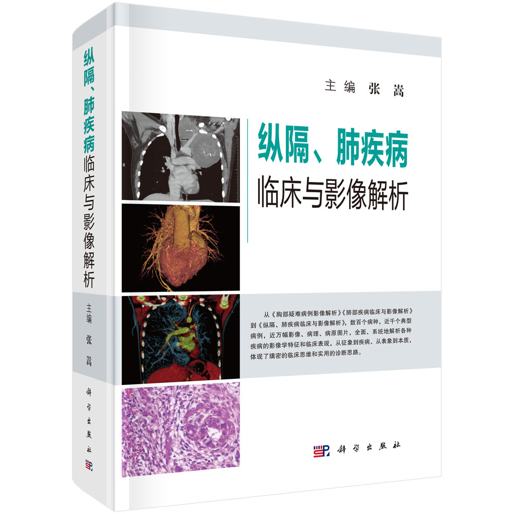 纵隔、肺疾病临床与影像解析