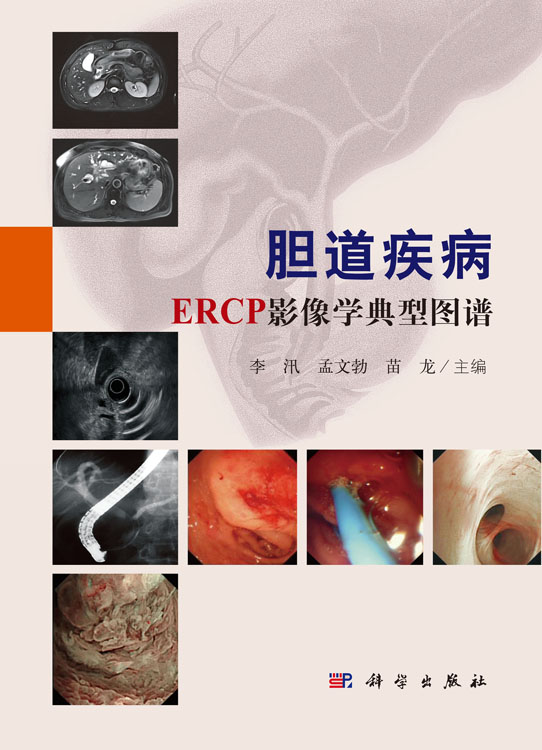 胆道疾病ERCP影像学典型图谱