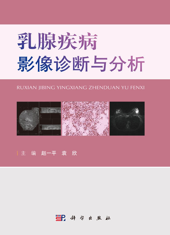 乳腺疾病影像诊断与分析