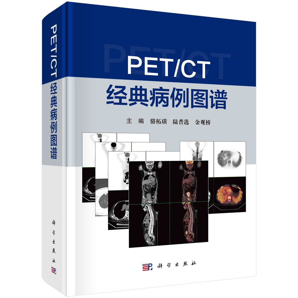 PET/CT经典病例图谱