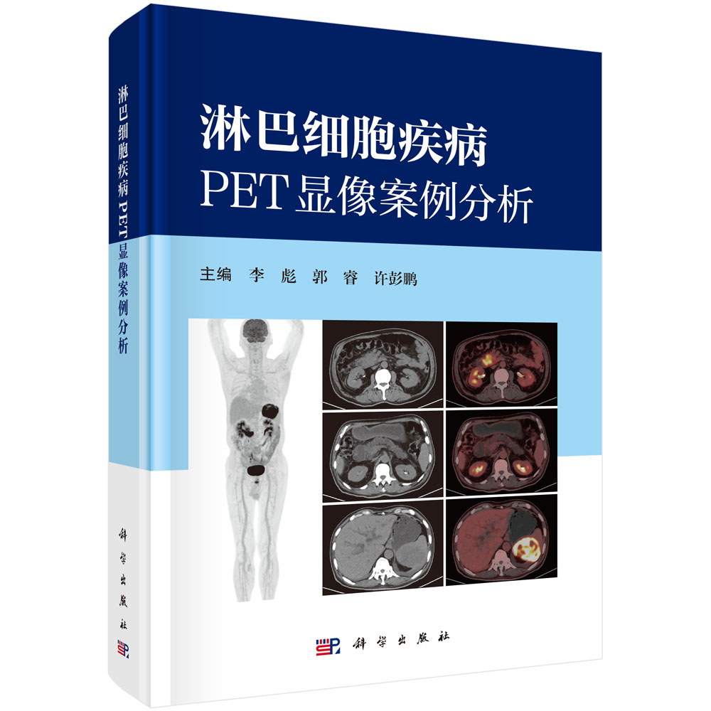 淋巴细胞疾病PET显像案例分析