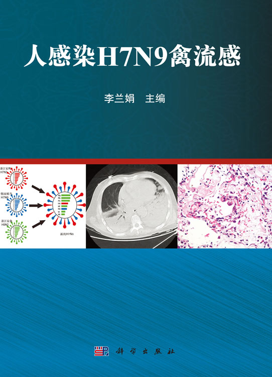 人感染H7N9禽流感