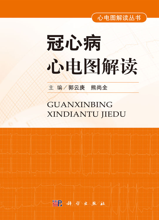 冠心病心电图解读