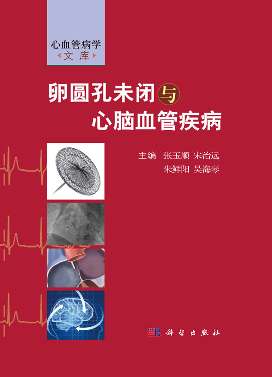 卵圆孔未闭与心脑血管疾病