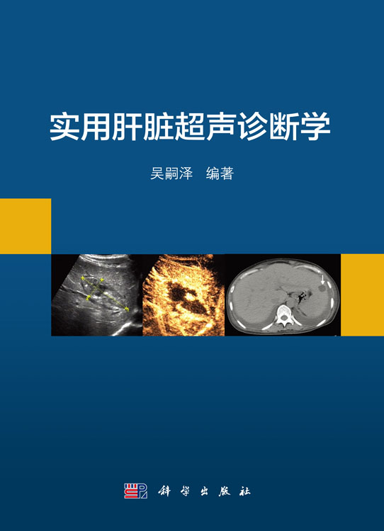 实用肝脏超声诊断学