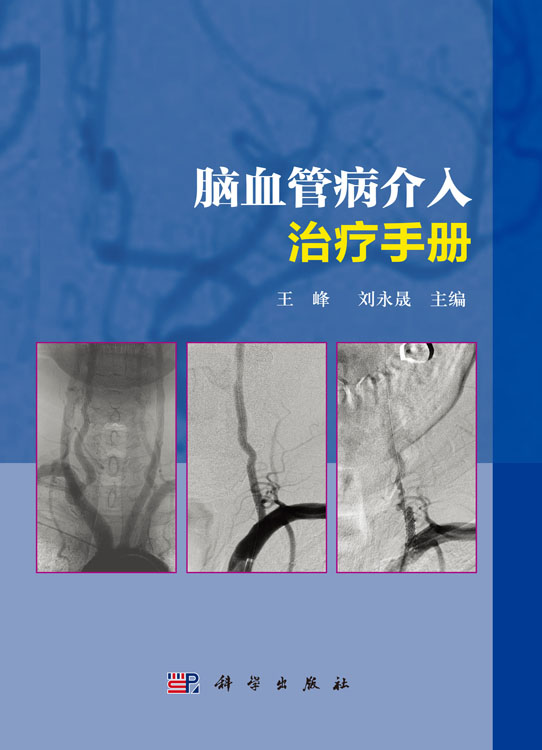 脑血管病介入治疗手册