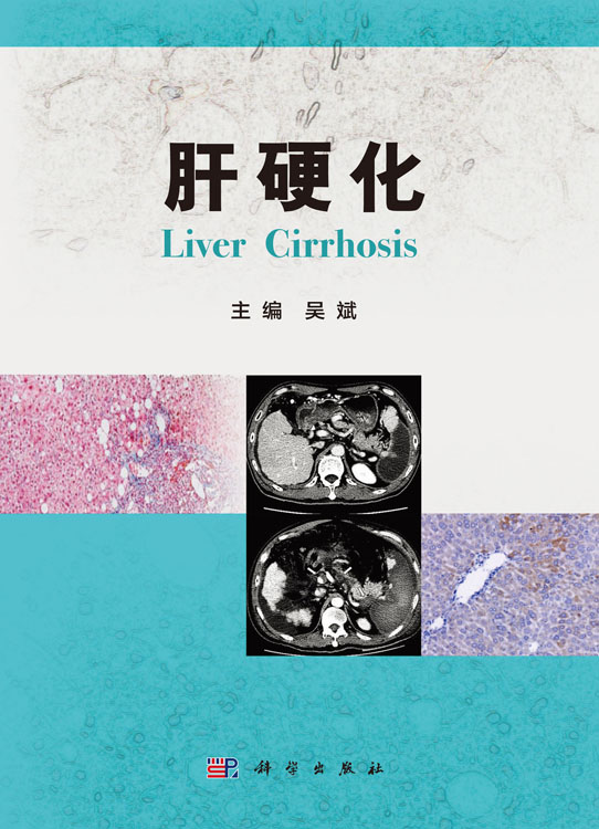 肝硬化