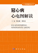 冠心病心电图解读