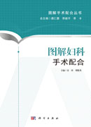 图解妇科手术配合