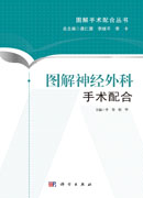 图解神经外科手术配合