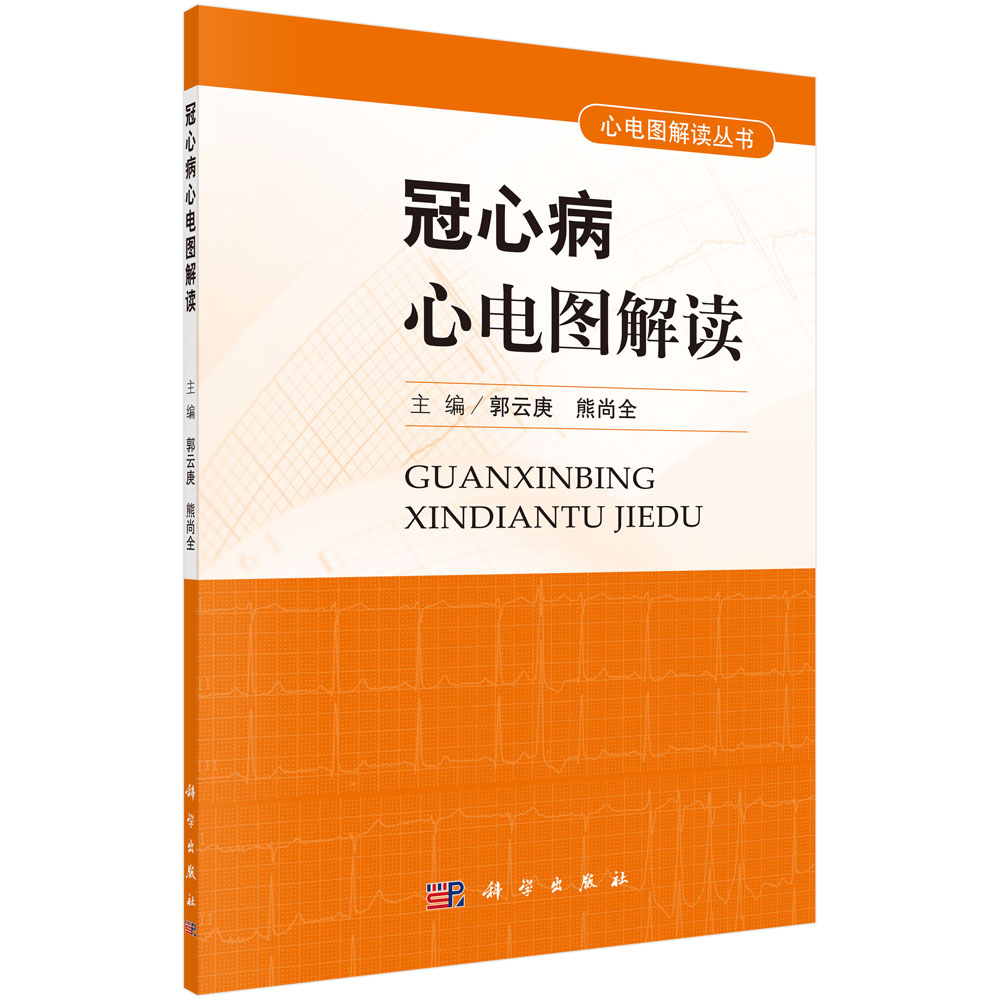 冠心病心电图解读
