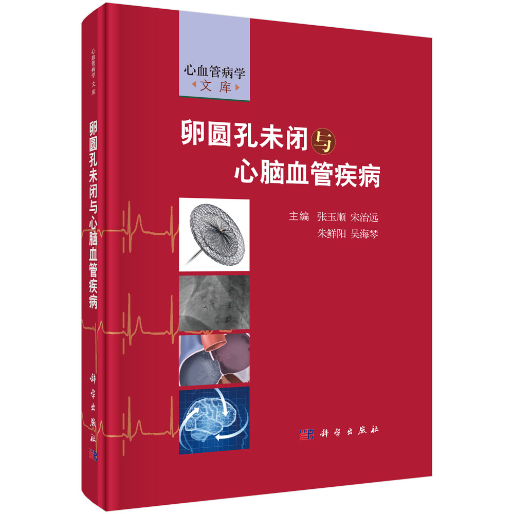 卵圆孔未闭与心脑血管疾病