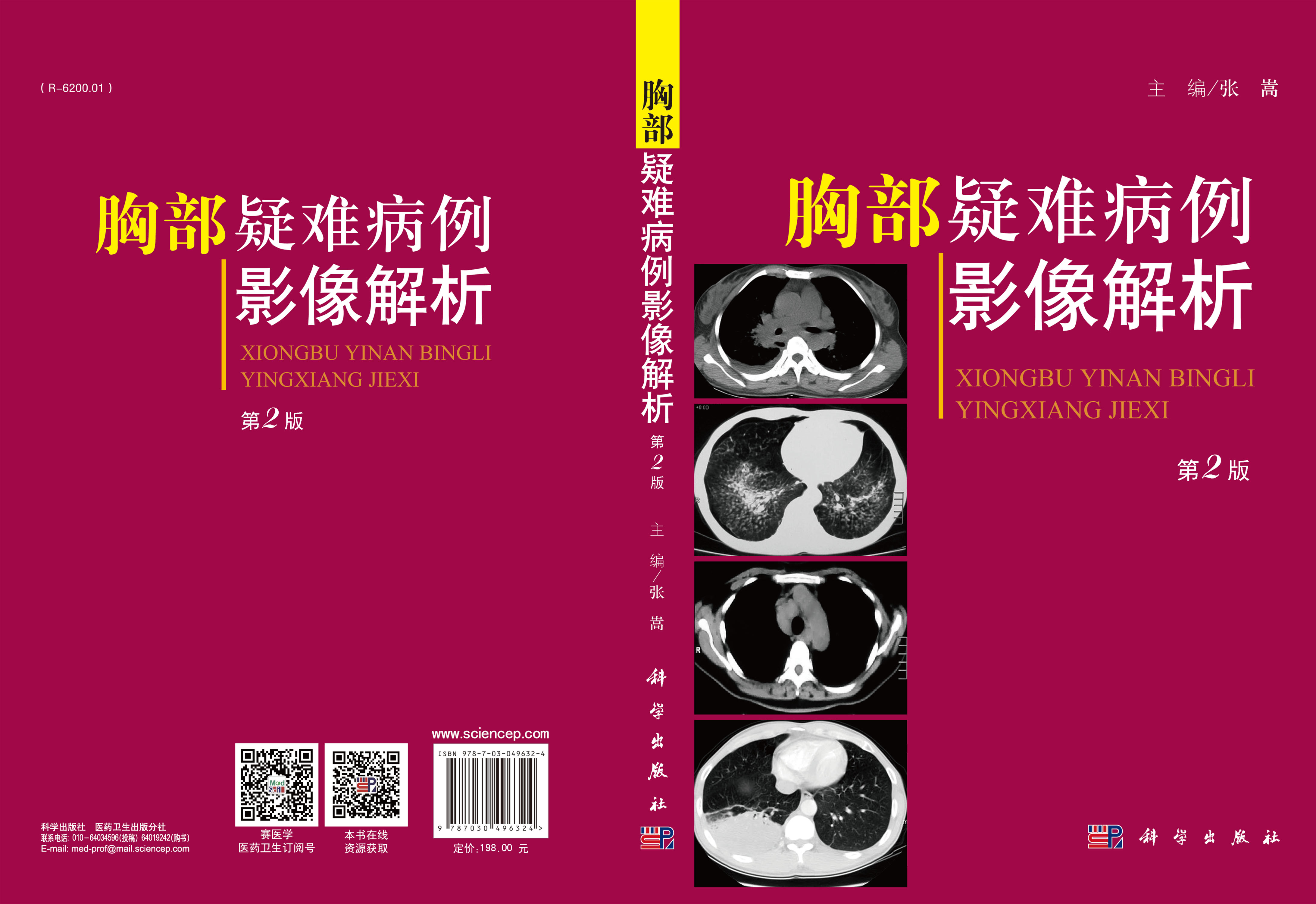 胸部疑难病例影像解析（第2版）