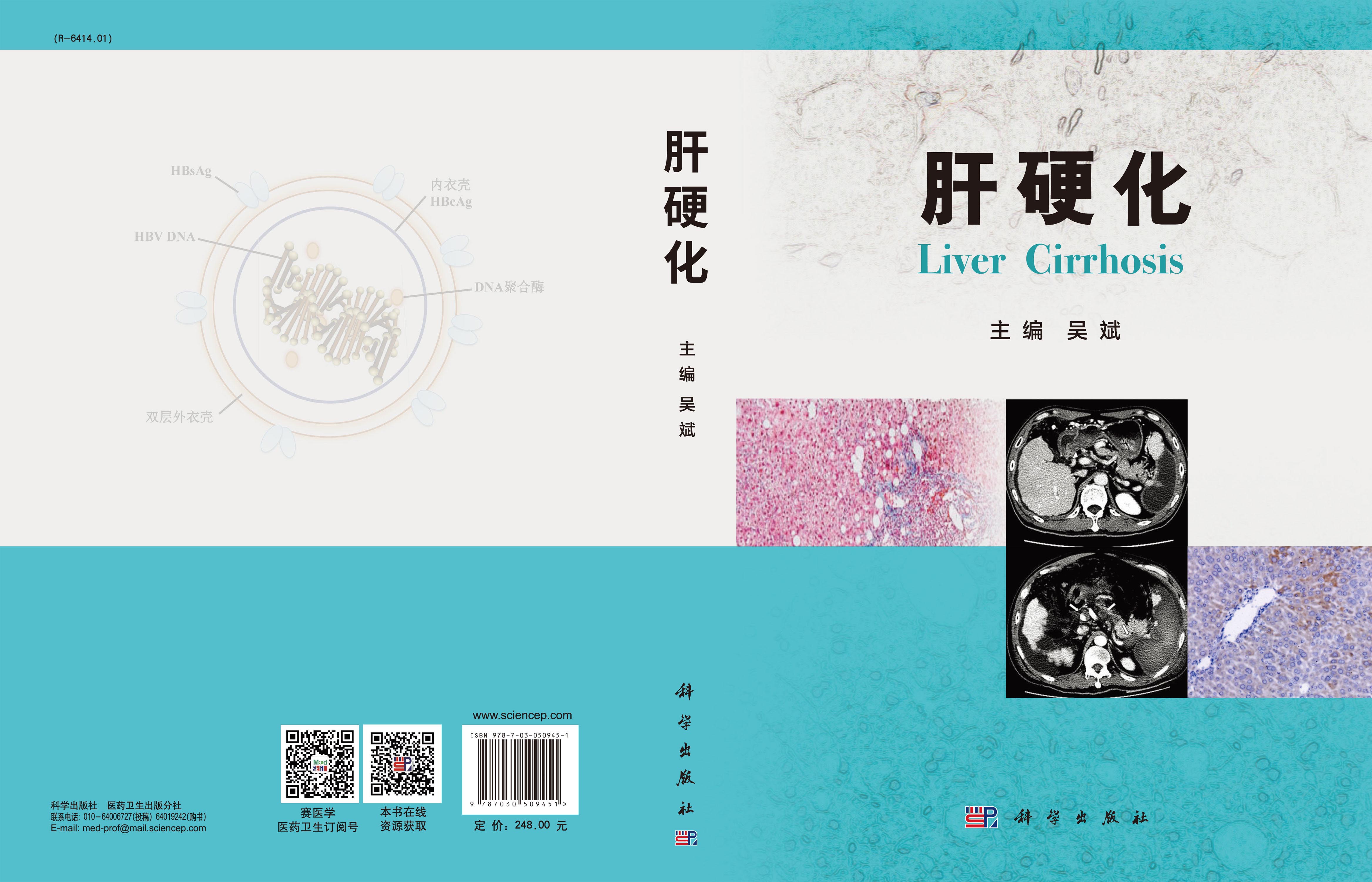 肝硬化