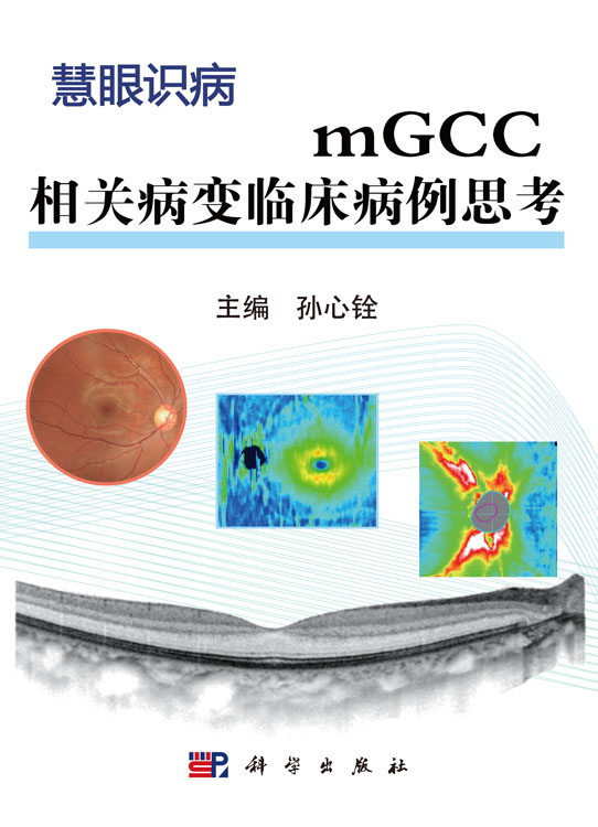 mGCC相关病变临床病例思考