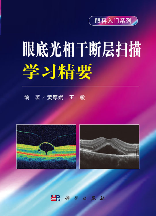 眼底光相干断层扫描学习精要