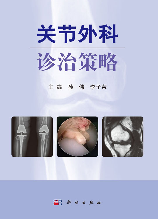 关节外科诊治策略