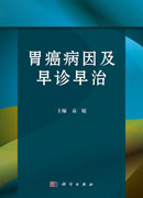 胃癌病因及早诊早治