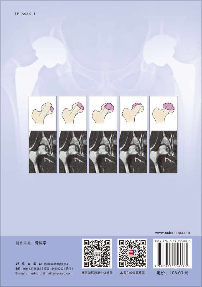 关节外科诊治策略