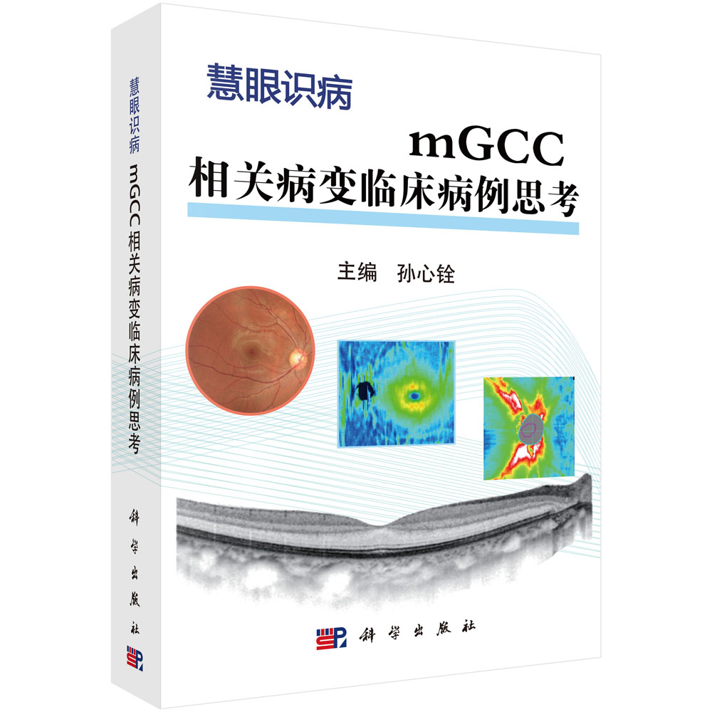 mGCC相关病变临床病例思考