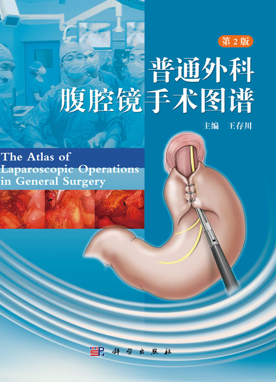 普通外科腹腔镜手术图谱（第2版）