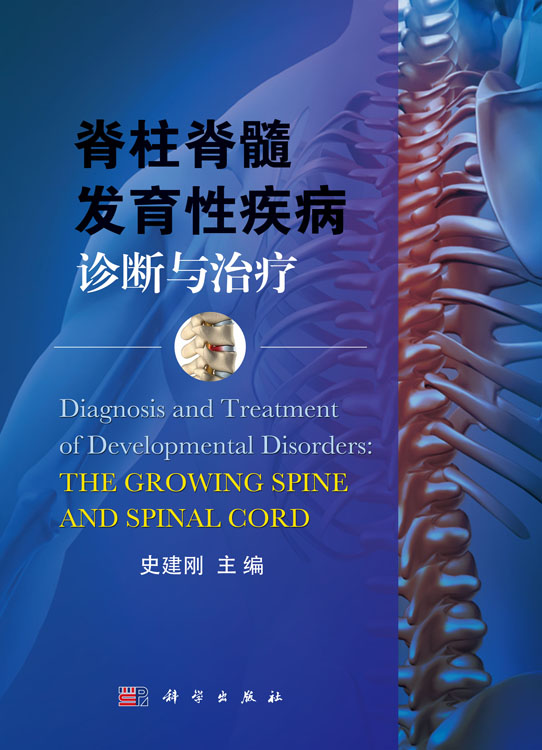 脊柱脊髓发育性疾病诊断与治疗