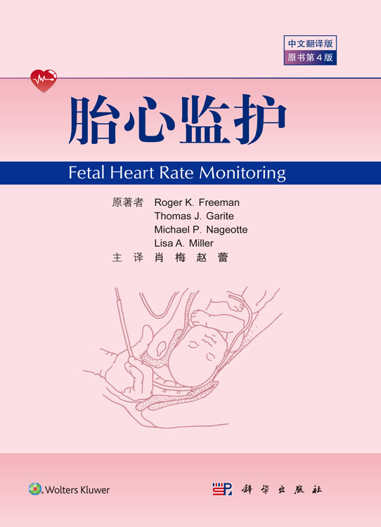 胎心监护