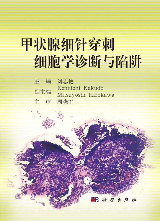 甲状腺细针穿刺细胞学诊断与陷阱
