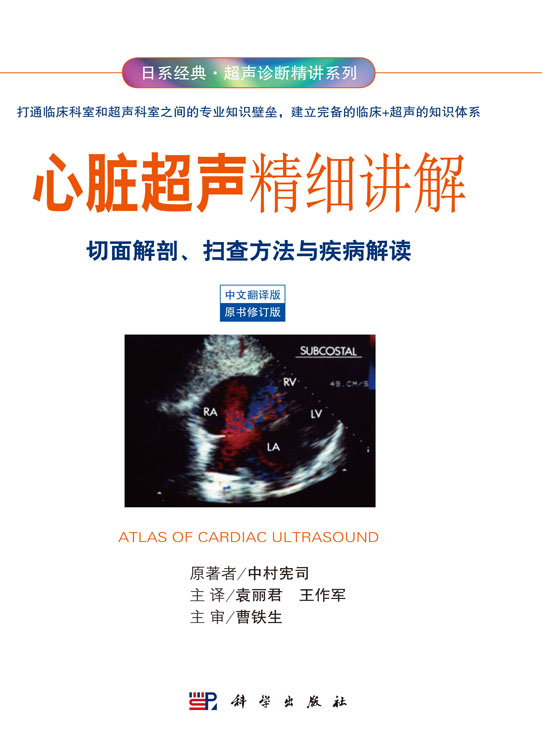 心脏超声精细讲解