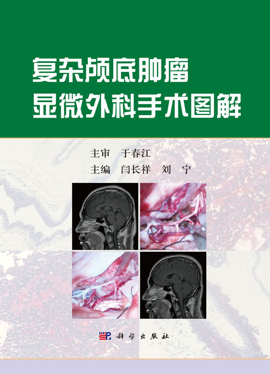 复杂颅底肿瘤显微外科手术图解