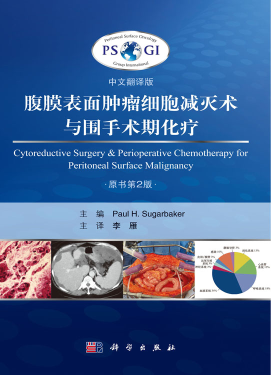 腹膜表面肿瘤细胞减灭术与围手术期化疗 (中文翻译版 原书第2 版 ）