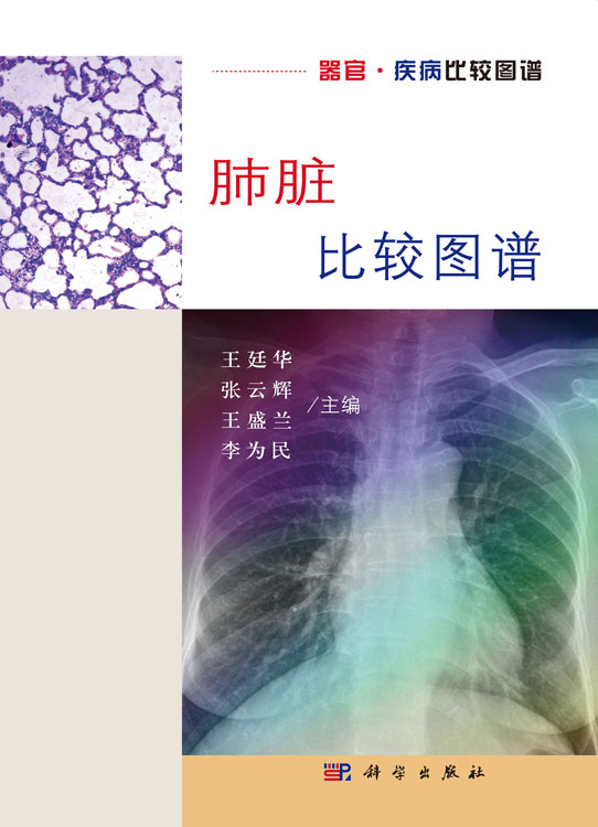 肺脏比较图谱