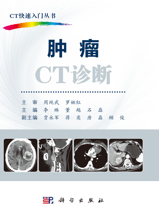 肿瘤CT诊断
