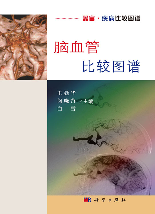 脑血管比较图谱