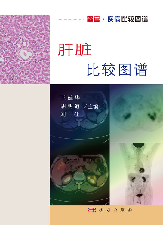 肝脏比较图谱