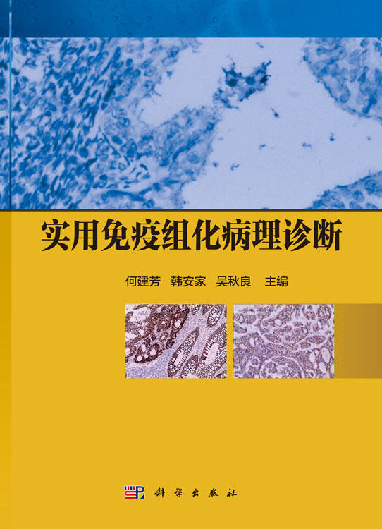 实用免疫组化病理诊断