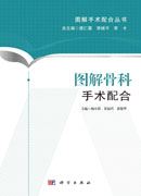 图解骨科手术配合