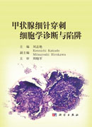甲状腺细针穿刺细胞学诊断与陷阱