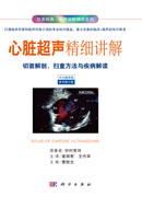 心脏超声精细讲解