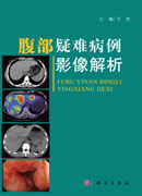 腹部疑难病例影像解析