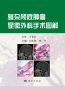 复杂颅底肿瘤显微外科手术图解