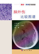 脑外伤比较图谱