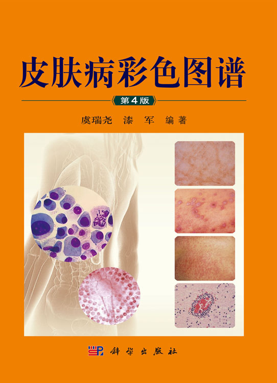 皮肤病彩色图谱