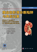 腹盆部影像诊断陷阱与典型征象