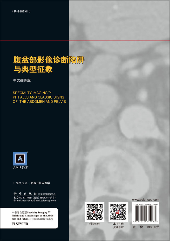 腹盆部影像诊断陷阱与典型征象