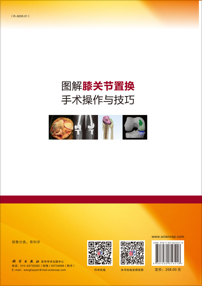 图解膝关节置换手术操作与技巧