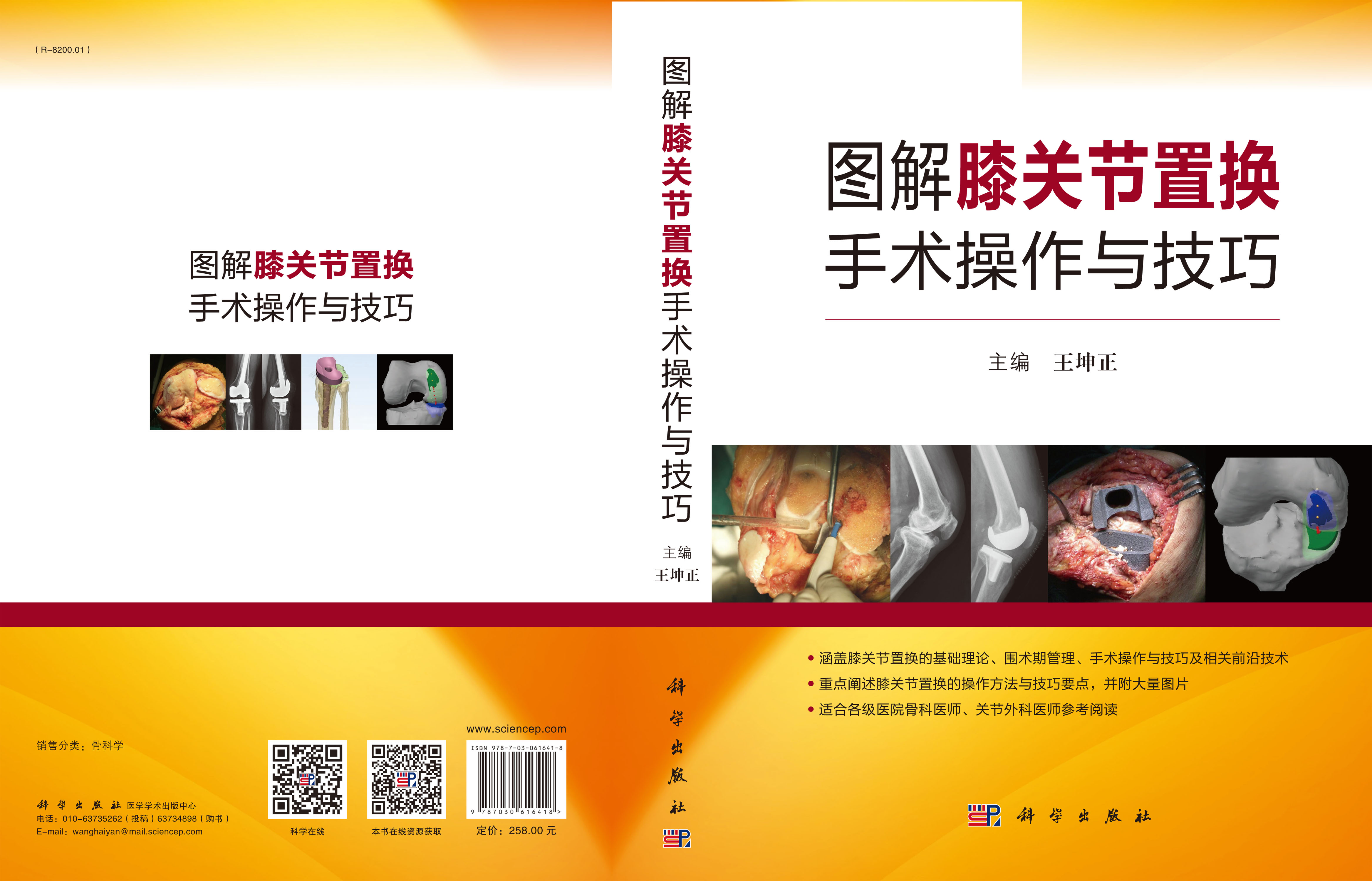 图解膝关节置换手术操作与技巧