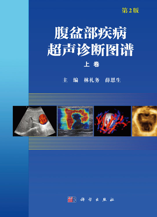 腹盆部疾病超声诊断图谱（上下卷，第2版）
